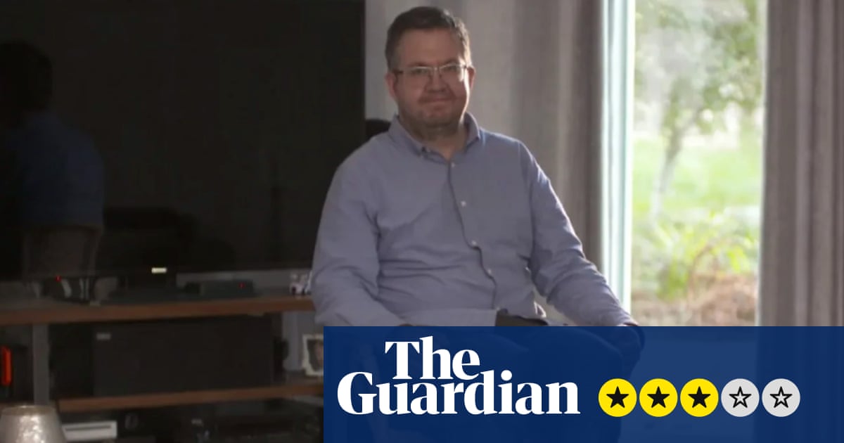 An Amputation Obsession: the Monster and the Surgeon review – an engrossing story, if you can stomach it | Television