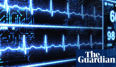 ‘Superhuman’ AI tool spots heart disease in less than 2 seconds | AI (artificial intelligence)