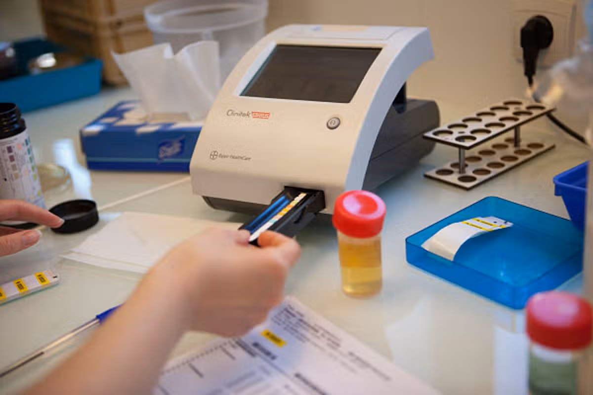 Urine test sample being analysed