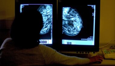 Row as private sector cancer centre announced for Wales
