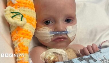 Macs Green is a small baby. He is lying in a hospital bed with a tube coming from his nose. He has an orange cuddly toy on his right