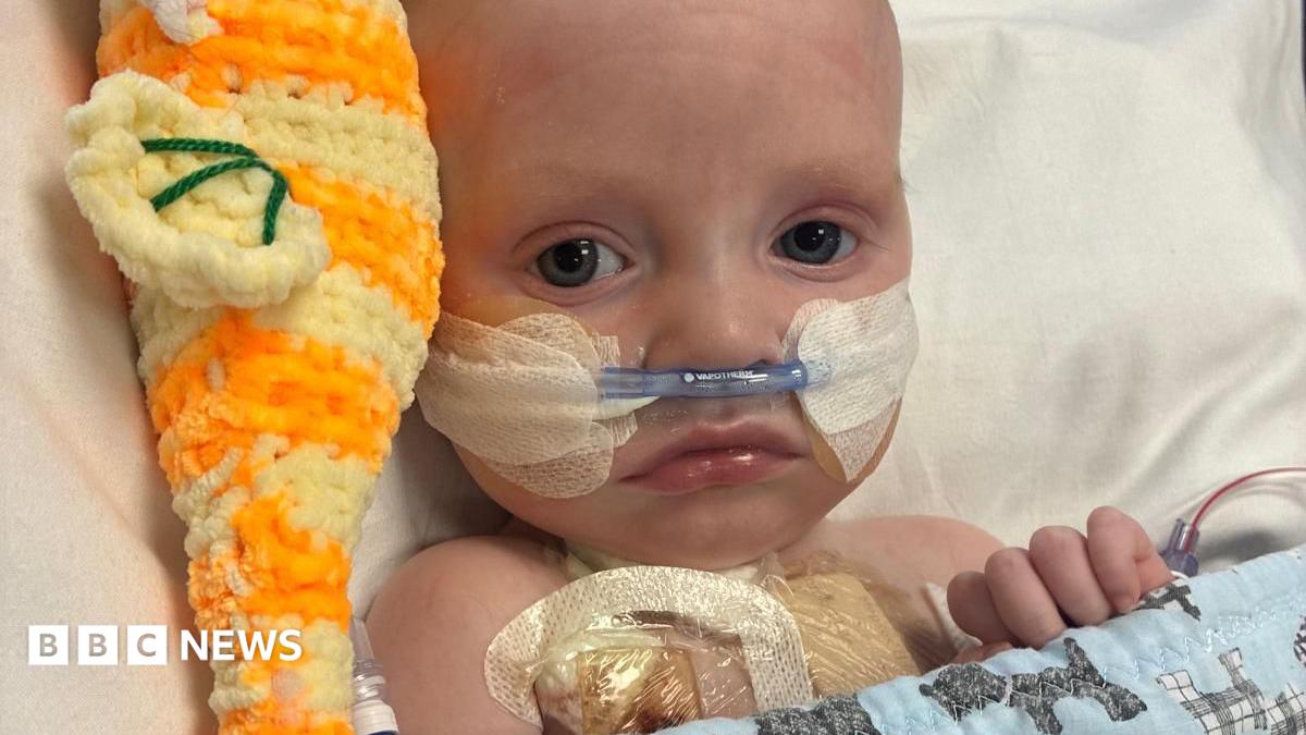 Macs Green is a small baby. He is lying in a hospital bed with a tube coming from his nose. He has an orange cuddly toy on his right