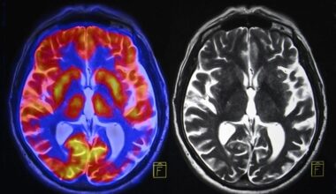 Color Black White Brain Scans