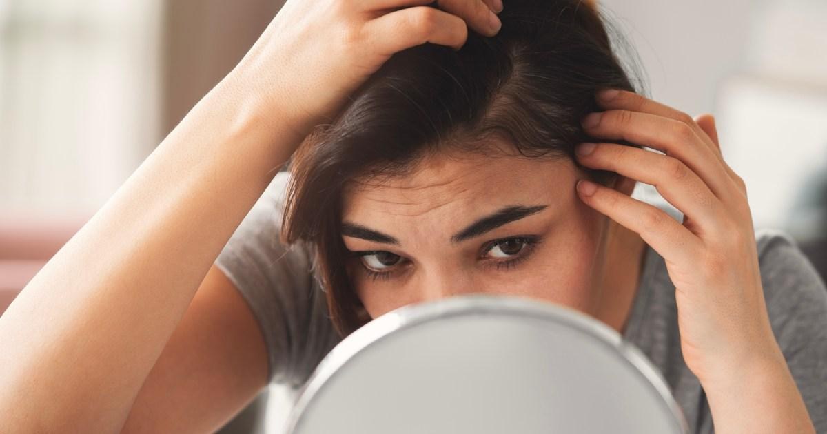 'Ozempic hair' is the latest side effect to be officially linked with weight loss jabs