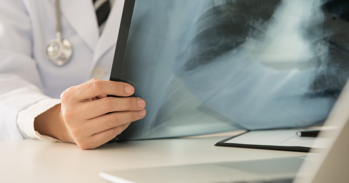 Radiologist who reviewed HSE patient scans had medical licence revoked in two countries – The Irish Times