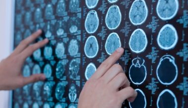 Scallop-derived plasmalogens may support brain health and memory
