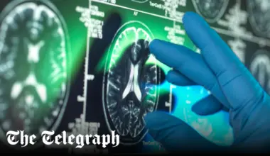 Alzheimer’s drug could save thousands in care costs