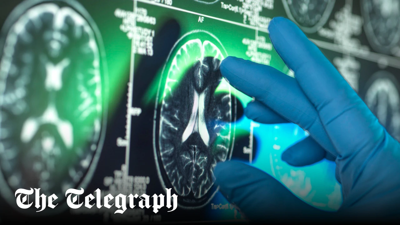 Alzheimer’s drug could save thousands in care costs