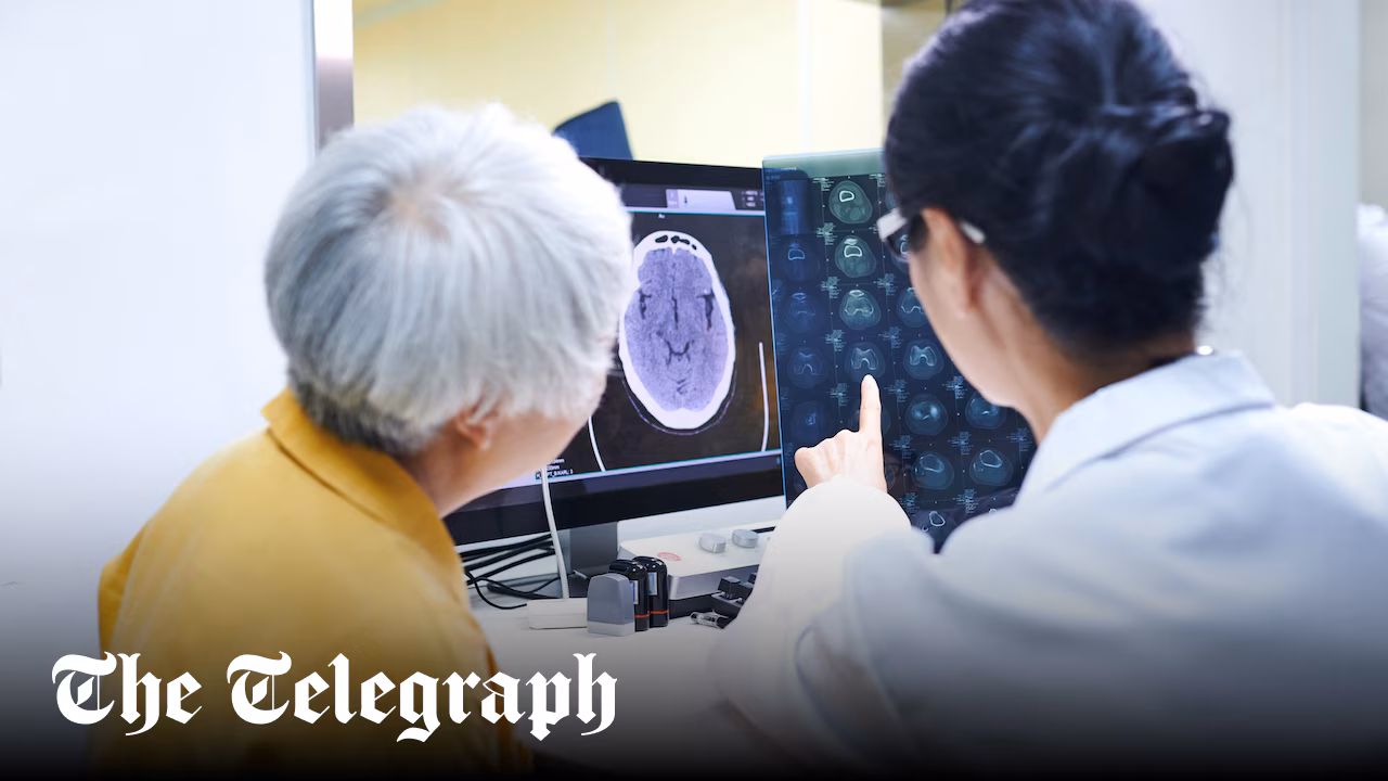 Can Alzheimer’s really be cured?