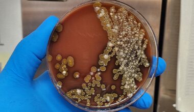 St Vincent Health Ministry monitors Drug-Resistant Bacteria at MCMH