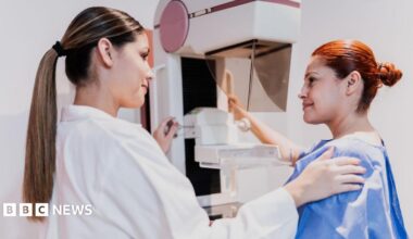 A female doctor doing mammogram exam on patient at hospital - stock photo. Both women have their hair tied back. The doctor is wearing a white lab coat and patient is wearing a blue gown.