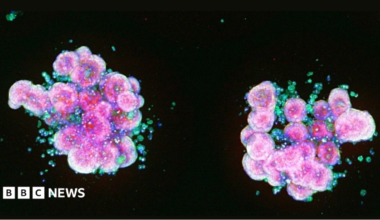 Microscopic image showing two clusters of pink and purple lab-grown cells, known as organoids, surrounded by smaller blue and green cells against a black background.