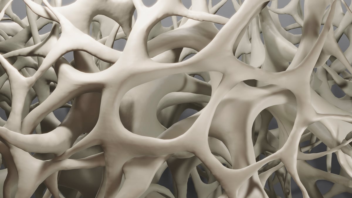 Rare Genetic Disorder Leaves Bones Unable to Harden – And Many Patients Don't Even Know They Have It : ScienceAlert