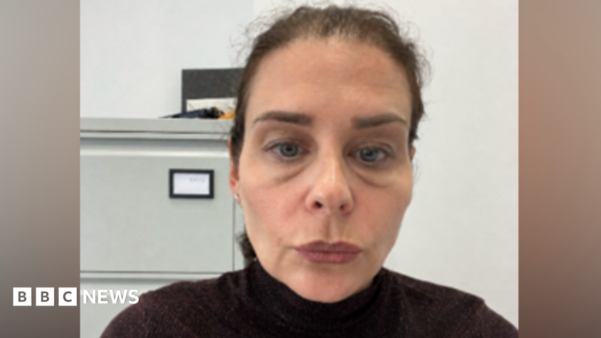 Head and shoulders image of Joanne Bauer in a black polo neck and with large bags under her eyes