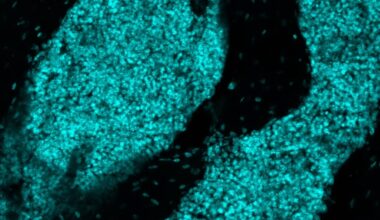 Scientists Discover a New Organ Hiding in The Skull : ScienceAlert