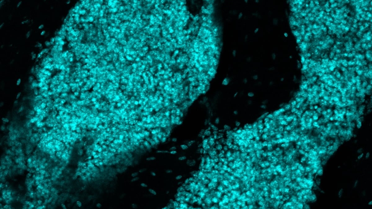 Scientists Discover a New Organ Hiding in The Skull : ScienceAlert