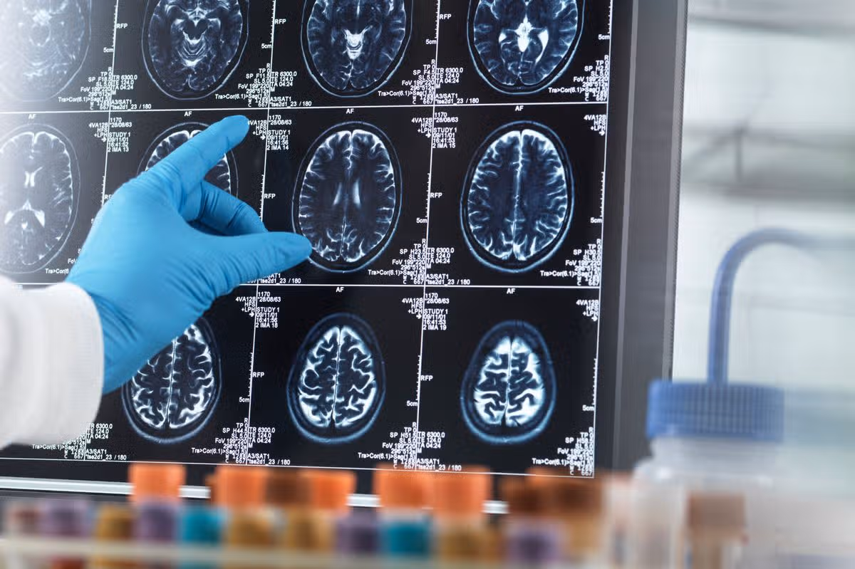 Patients across the UK will be recruited for the study (file photo)