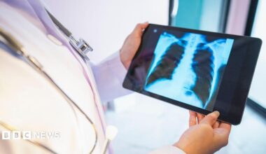 Library image of a doctor in a white gown looking at a lung scan on a handheld device.