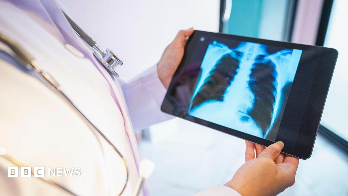Library image of a doctor in a white gown looking at a lung scan on a handheld device.