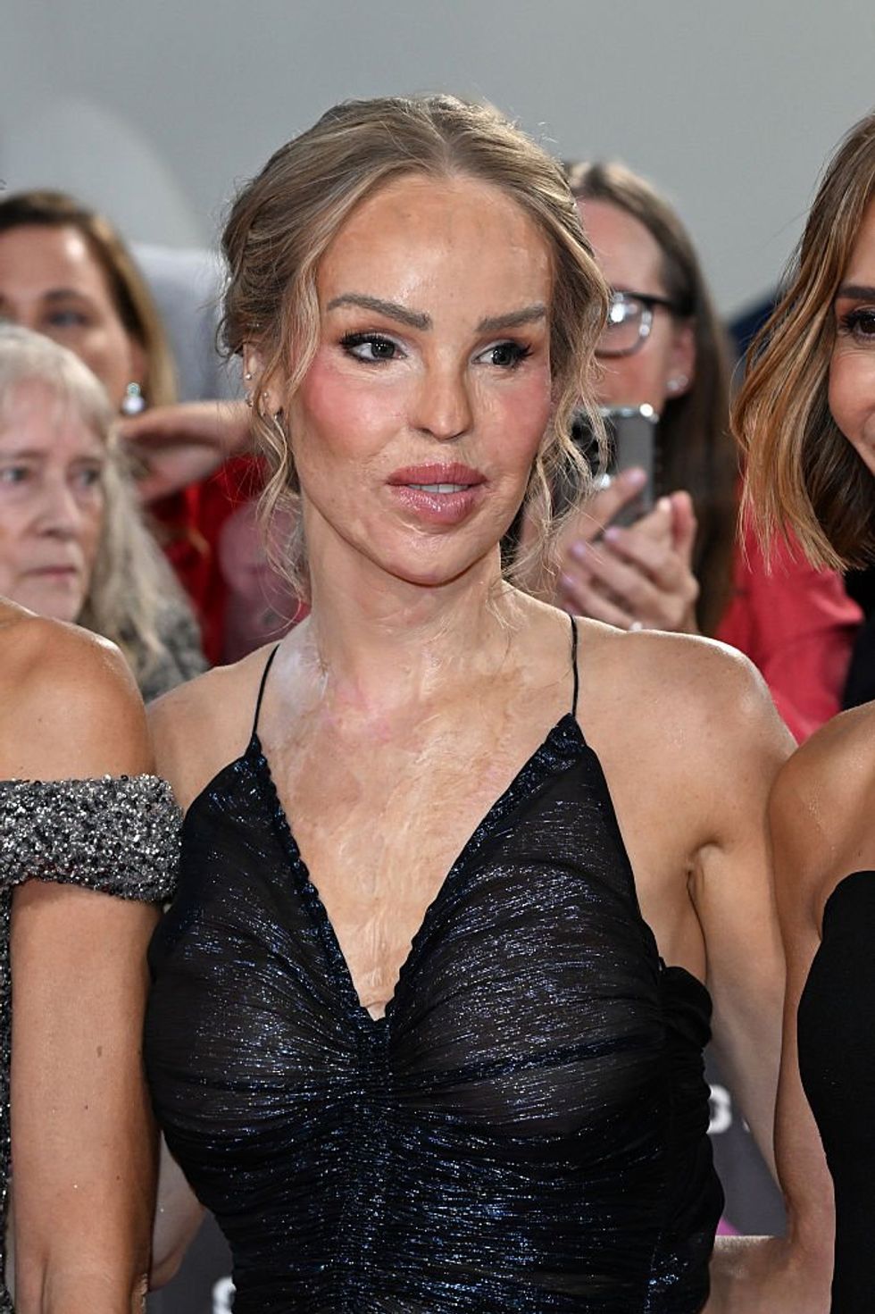 Katie Piper