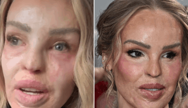 Katie Piper breaks down as she details vile messages over NTA appearance: 'I know I'm not the prettiest'