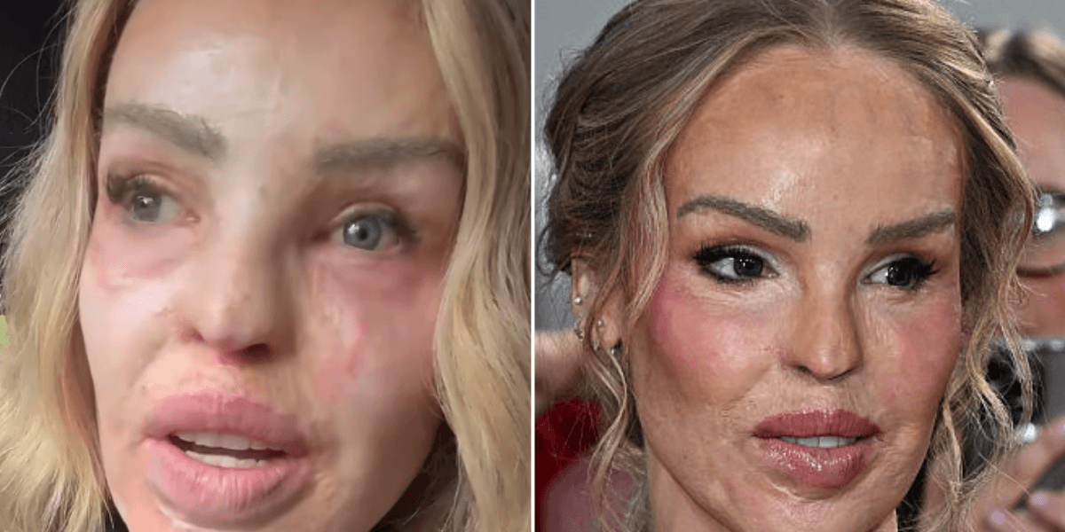 Katie Piper breaks down as she details vile messages over NTA appearance: 'I know I'm not the prettiest'
