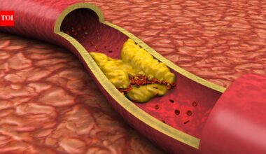 High cholesterol gets all the attention, but a nephrologist explains the other health risks that could matter more for the heart