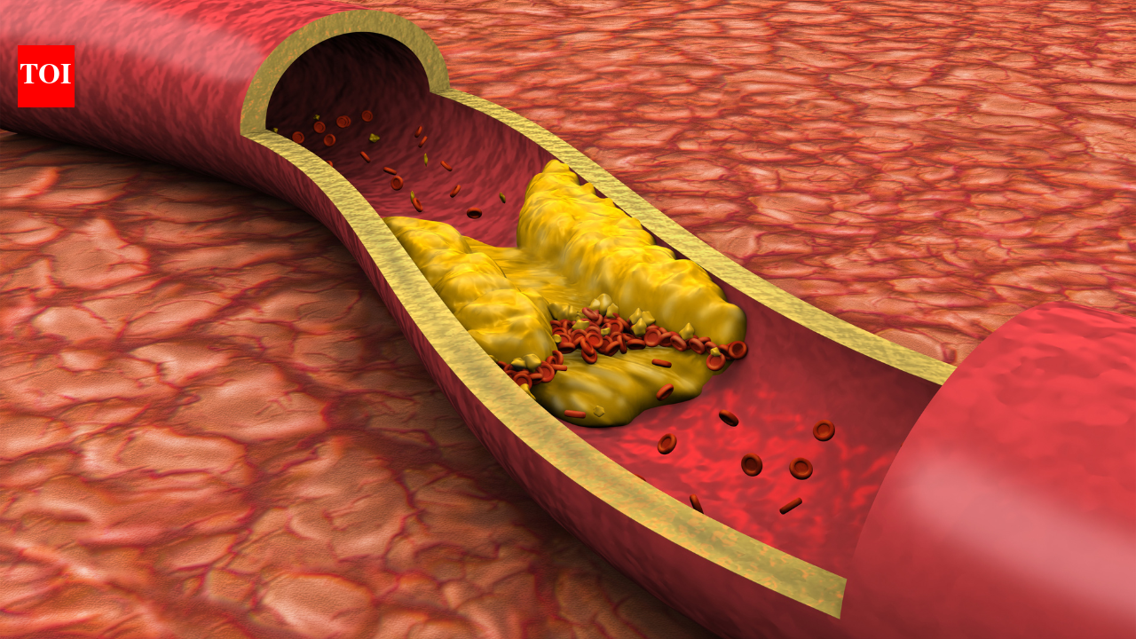 High cholesterol gets all the attention, but a nephrologist explains the other health risks that could matter more for the heart