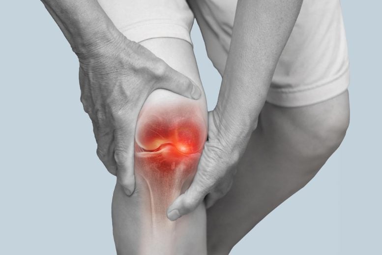 Hands Holding Knee Pain Degenerative Arthritis