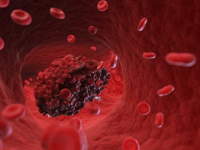 Illustration of a blood clot.