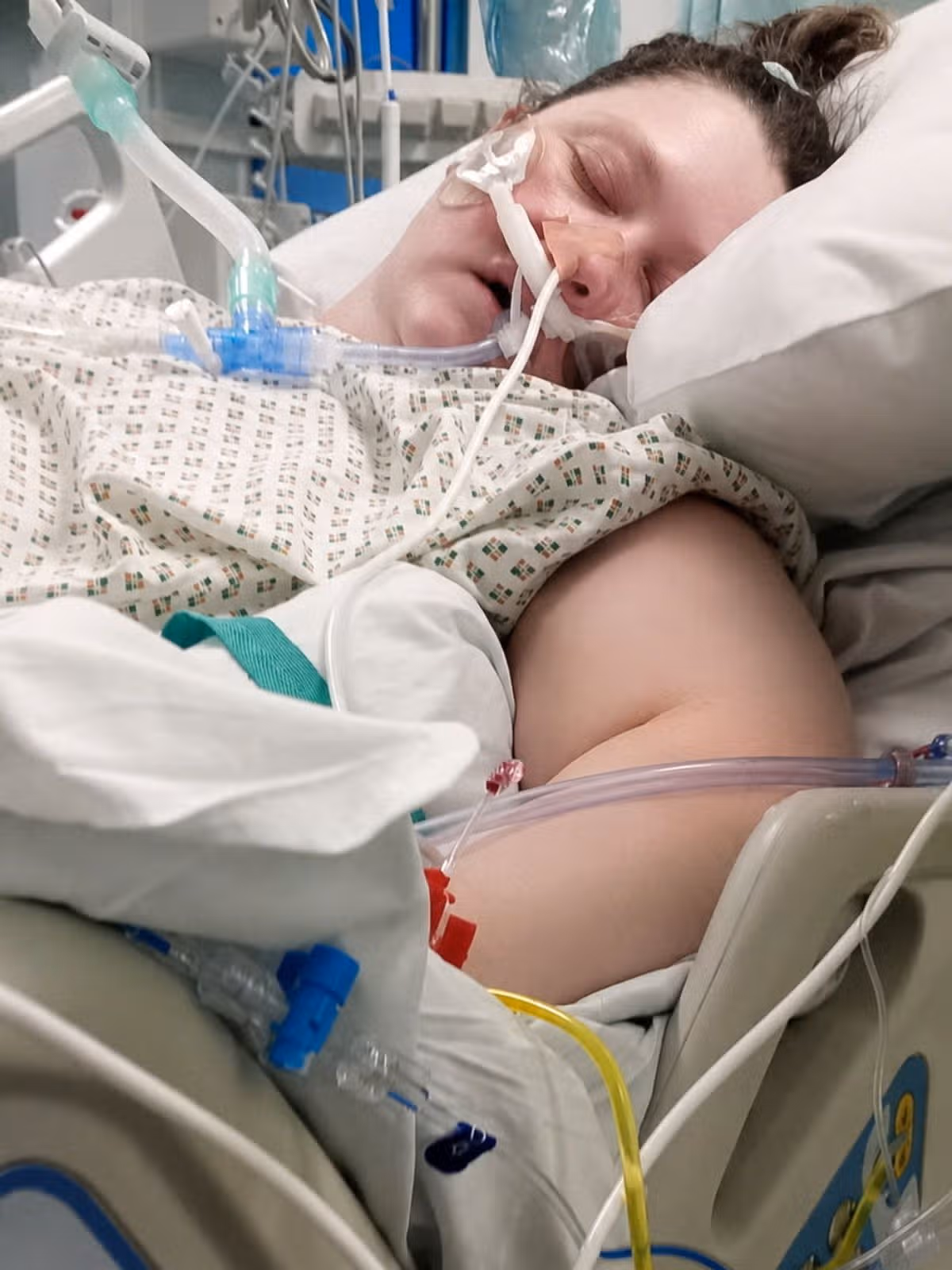 Clare was induced into a coma due to the severity of the surgery but failed to wake once in recovery