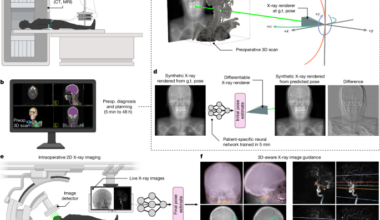 Rapid patient-specific neural networks for X-ray to volume registration