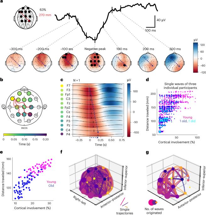 Human tau pathology is associated with lonely, nontraveling slow waves linked to memory impairment
