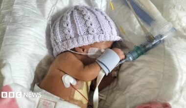 A premature baby is lying in a cot attached to breathing tubes and other equipment with a lilac hand-knitted hat on.