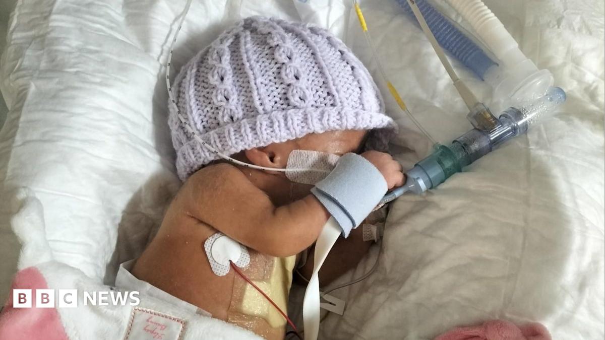 A premature baby is lying in a cot attached to breathing tubes and other equipment with a lilac hand-knitted hat on.