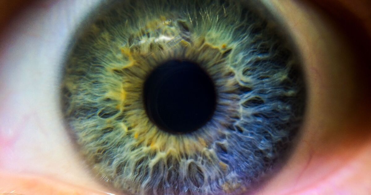 Experts issue warning over serious condition as cases expected to soar