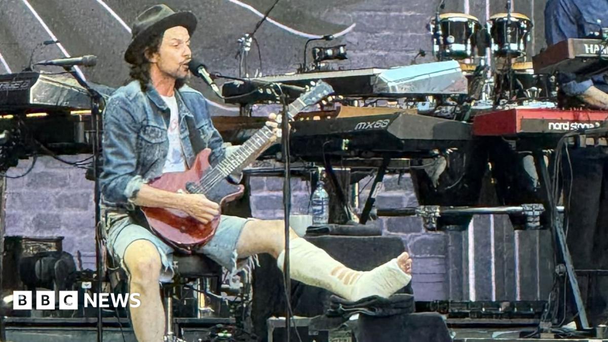 A man sitting down and singing with a guitar with his left leg in a cast and propped up on a stool. He is wearing shorts and a denim jacket and hat, perched at an angle on his head. There are keyboards and drum kits on the stage in the background.
