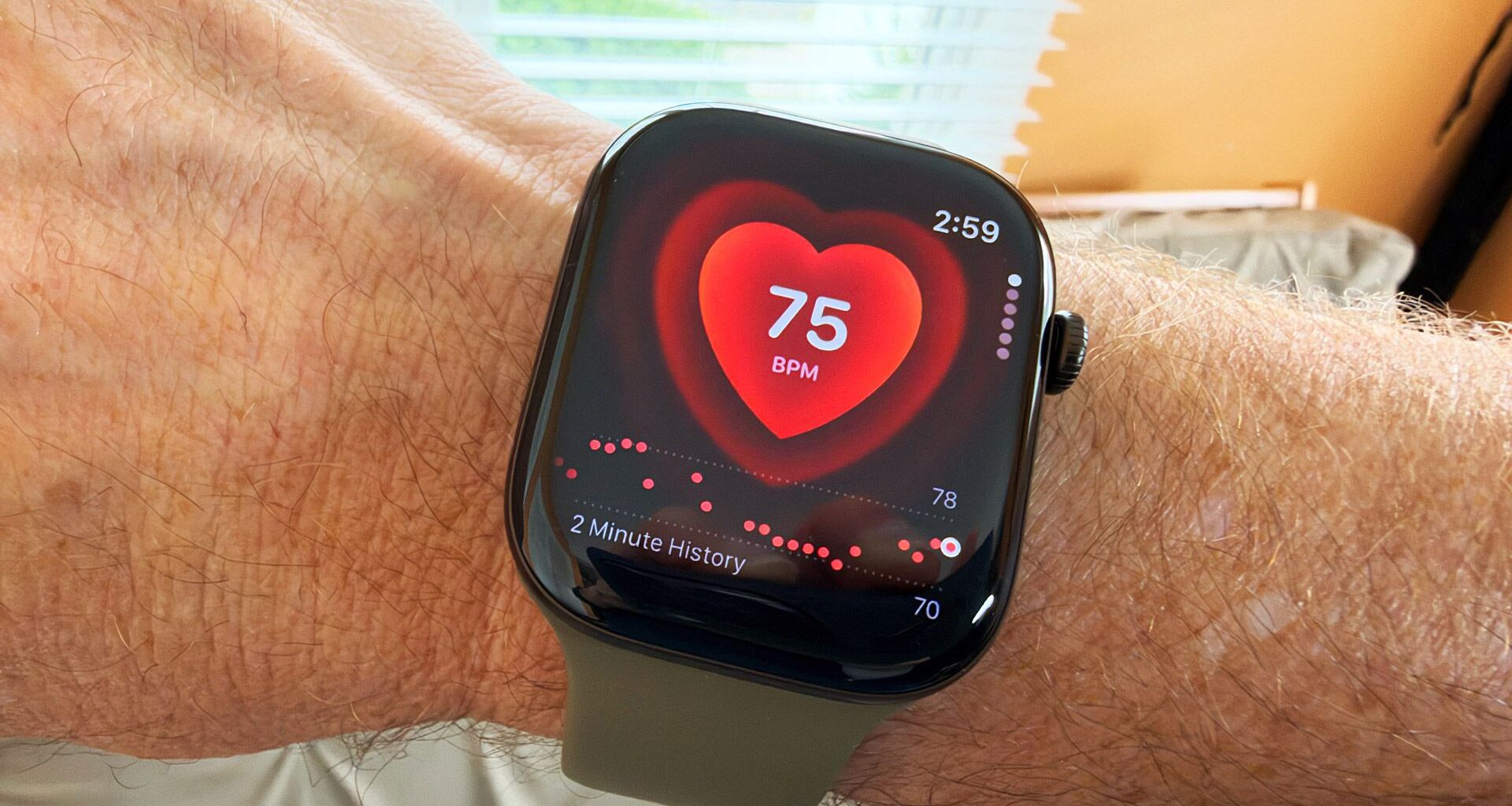 Apple Watch Series 12