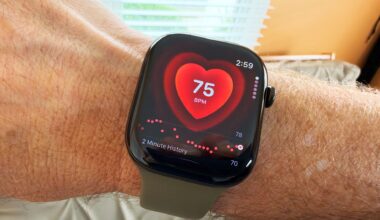 Apple Watch Series 12