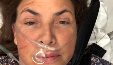 Kirstie Allsopp shares update after horror injury during birthday trip - The Independent