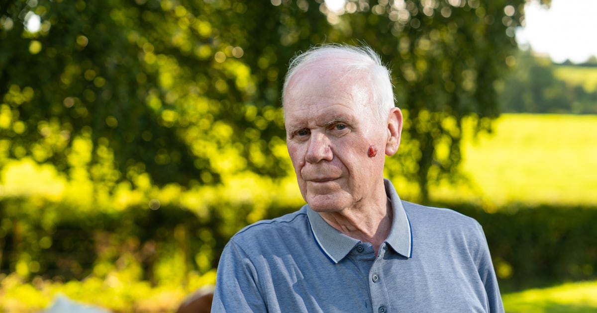 Fermanagh pensioner left waiting on ‘urgent’ list as cancerous growth on face doubles in size fears he may have to spend thousands on private treatment