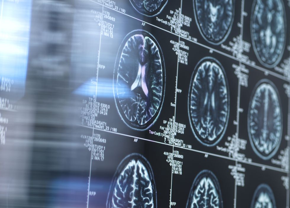 BRAIN SCAN