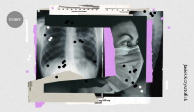 When do infections lead to long COVID? Scientists close in on triggers and treatments for post-viral syndromes