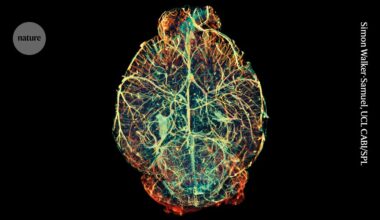 How to make a brain: new experiments challenge existing picture