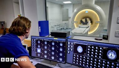 A man stands in front of brain scans and a MRI scanner through the glass window