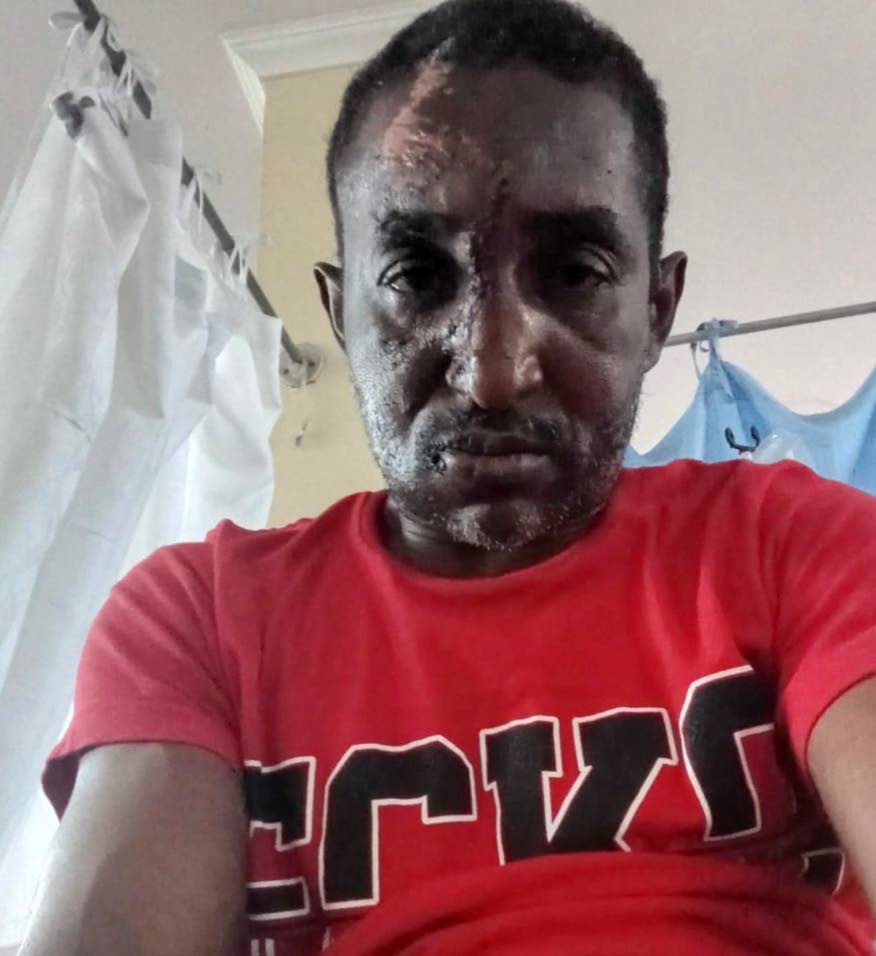 Spanish Town Hospital rejects negligence claim over crash victim's 10-month surgery wait