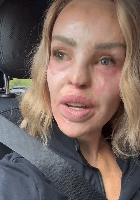Katie Piper