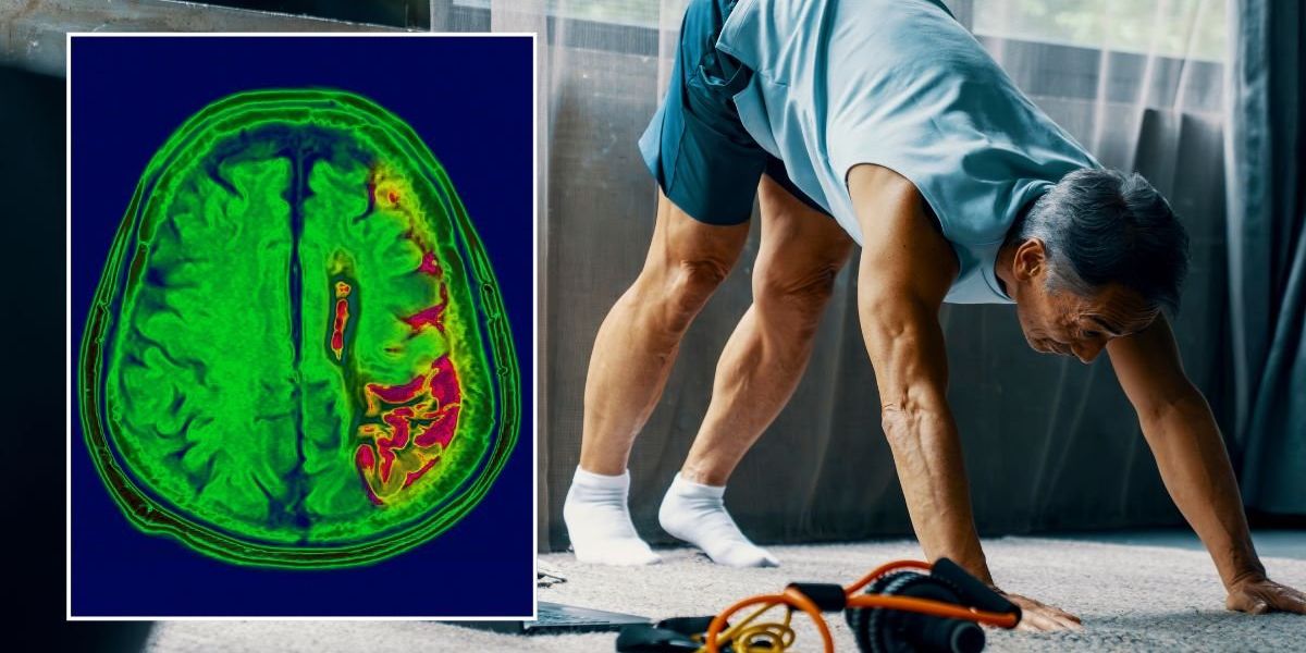Dementia: Best types of exercise for cutting risk revealed in study of 4.2 million people