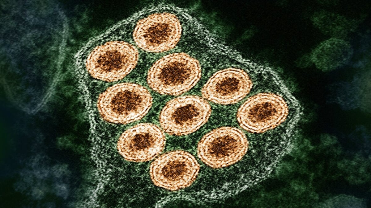Over 90% of Human Rabies Cases in The US Aren't Detected, Study Finds : ScienceAlert