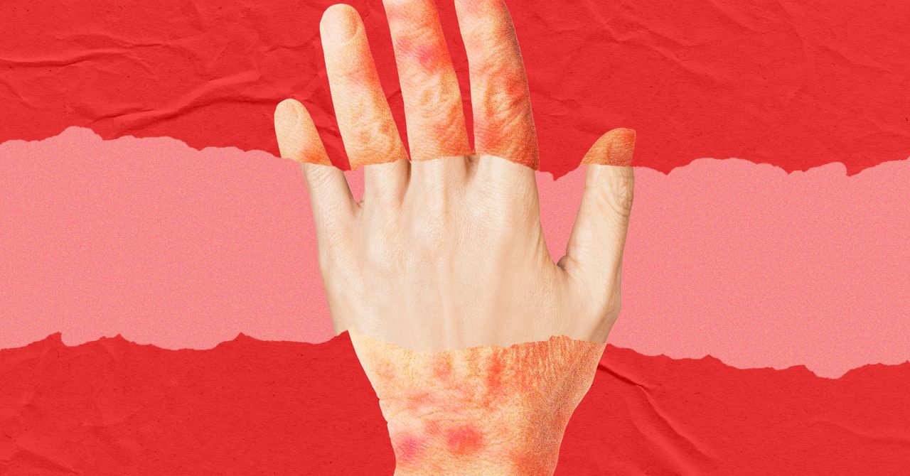 A New Anti-Aging Drug Looks to Turn Back the Clock on Skin Age